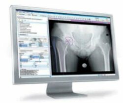 AGFA IMPAX 6.0 example of user interface displayed on monitor