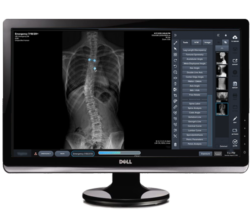 Pinnacle V-Tech Chiro panel