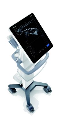 Mindray TE5 US podiatry