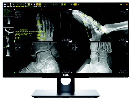 Blue Ridge Mri 20/20 PXS-710D - Blue Ridge Imaging Technologies