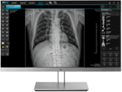 Image of AquiMax software on computer screen